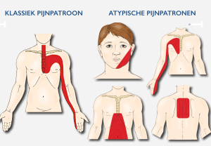 pijnpatroons